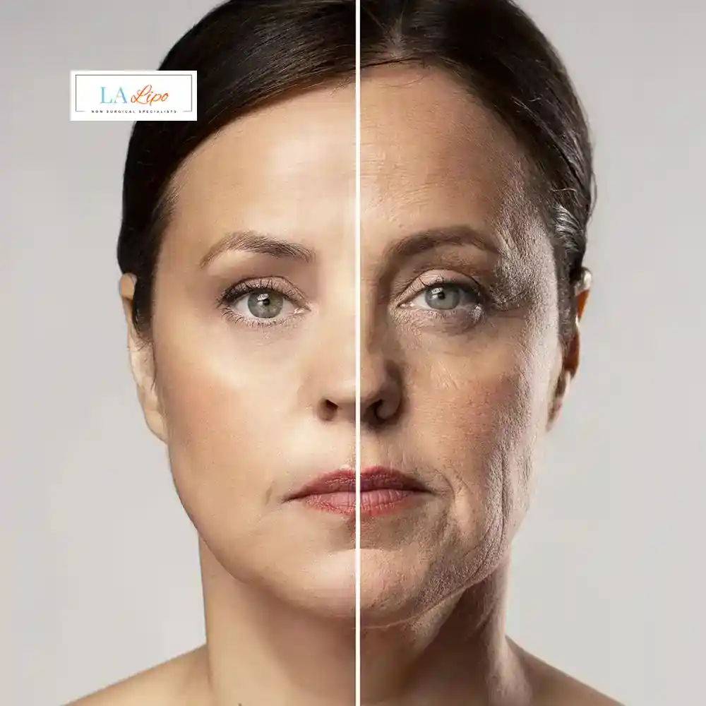 How Can You Tell If Non-Surgical Skin Tightening Is Right for You Enfield Island Village?
